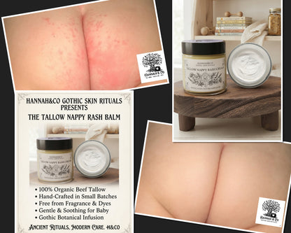 Baby Creams & Balms